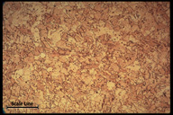 Microstructure