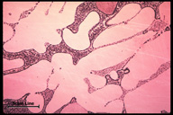 Microstructure