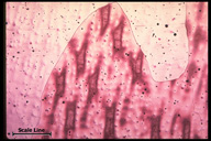 Microstructure