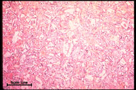 Microstructure