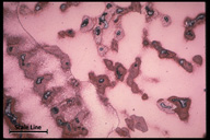 Microstructure