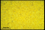 Microstructure